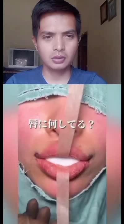 0p3r4s1 bibir 
#fypシ゚viral #viralvideo #viralshots