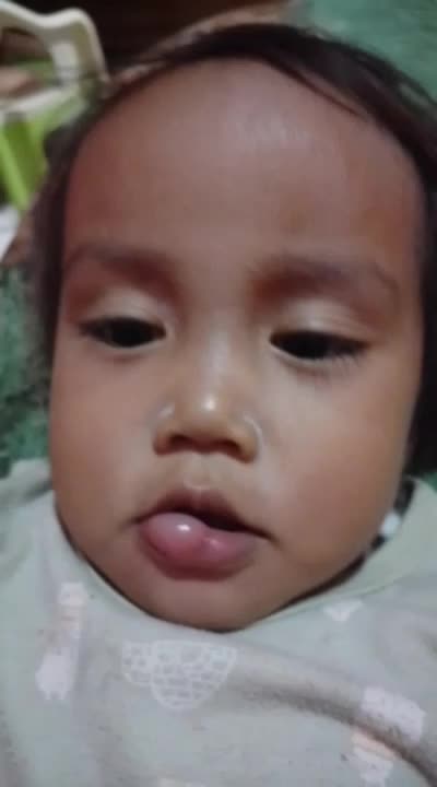 ada yg tau ga ya, bibir kayla kenapa bangun tidur uda kaya gitu aja kasian.😔
#seranggaapa
#jiwayangbersedih 