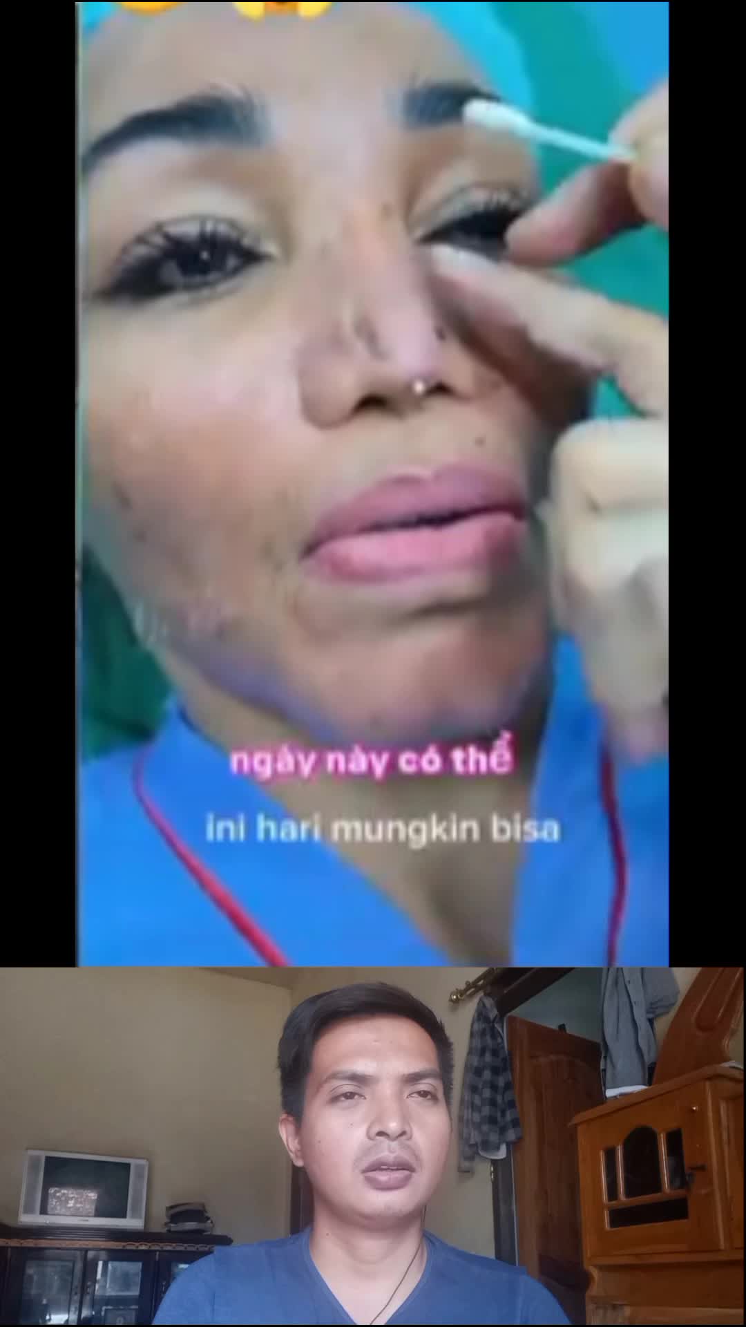 ibu ini. m3n4ngis karena 0p3r4s1 wajahnya g4g4l #fypシ゚viral  #viralvideo 