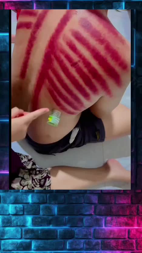 Cara Kerikan Gak Pakai Koin
 #kerikan  #kerok  #cara  #simple 