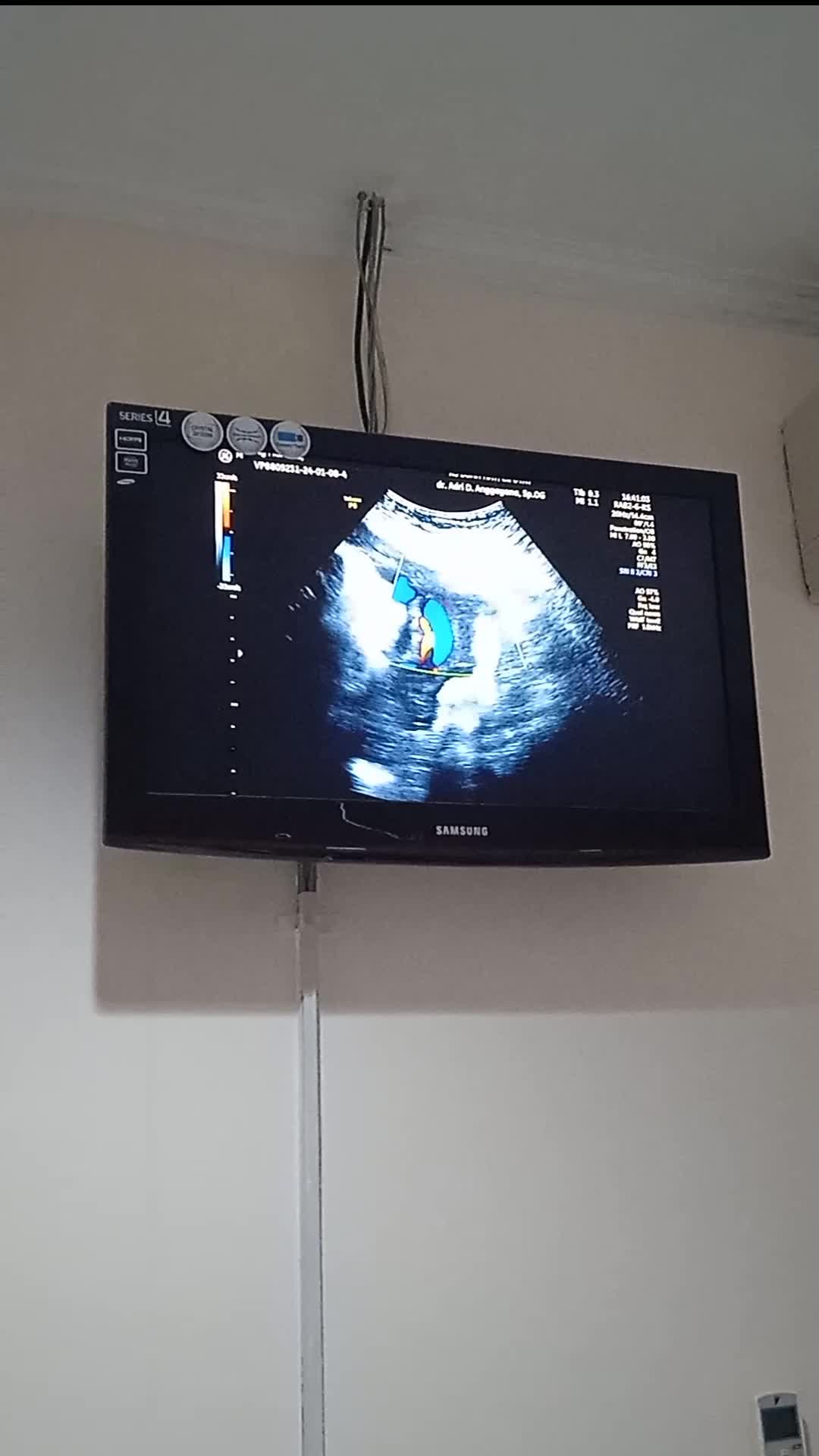 penantian terindah..😘