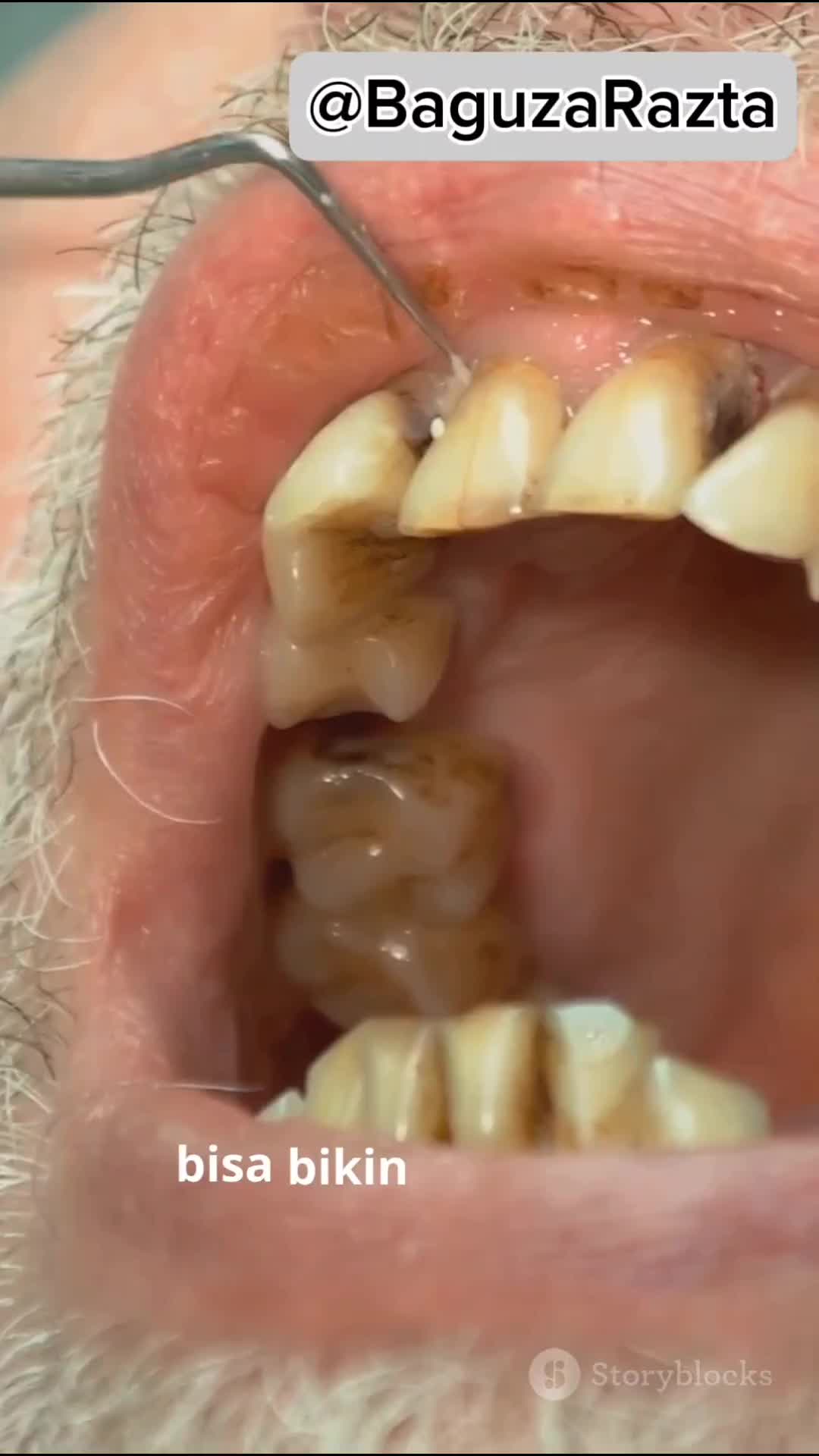 Kenapa Gigi Manusia Tidak Tumbuh Terusmenerus #fyp #faktaunik #faktamenarik #fakta 