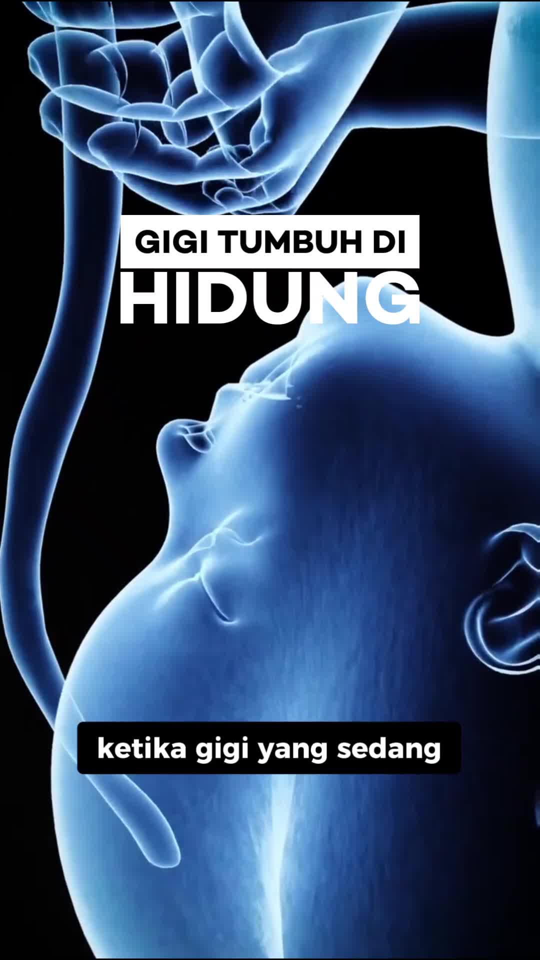 Gigi bisa tumbuh di hidung 