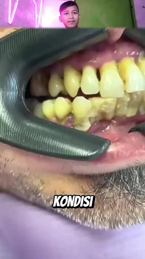 halo  #RCTIPlus  #HOTrctiplus  #rcti  #RCTIoke  #Viral  #trending  #hiburan   #andri