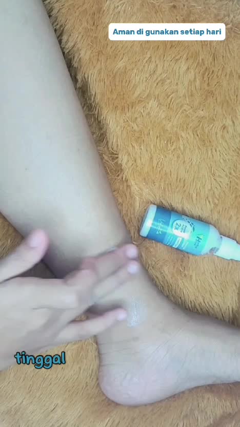 atasi Varises mu dengan valesin
cek di kerkun tiktokku ya
