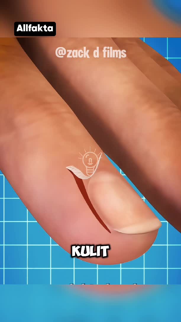 jika terkena bintil kuku