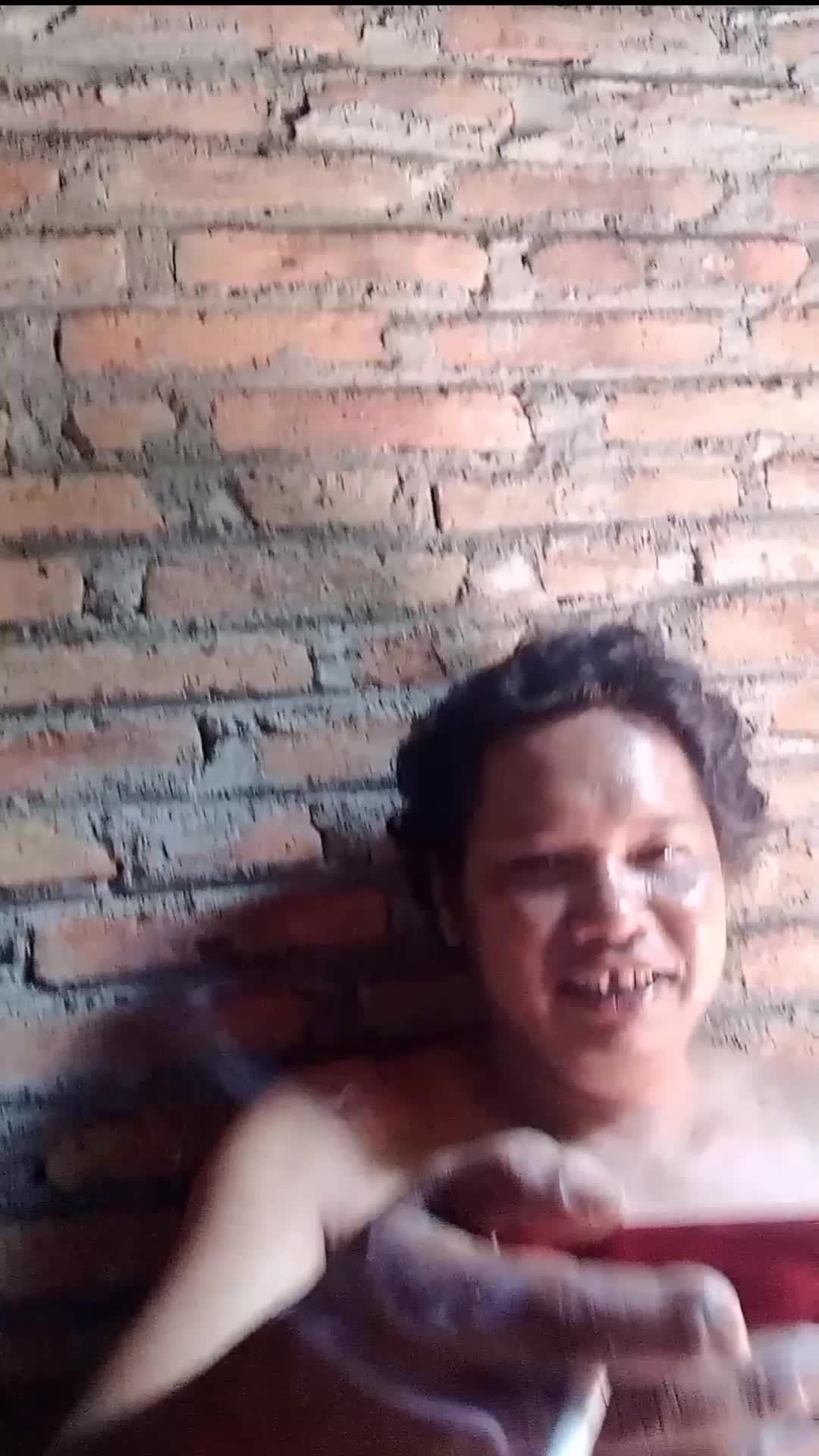 Keluarga Gigi Ompong Depan Atas 