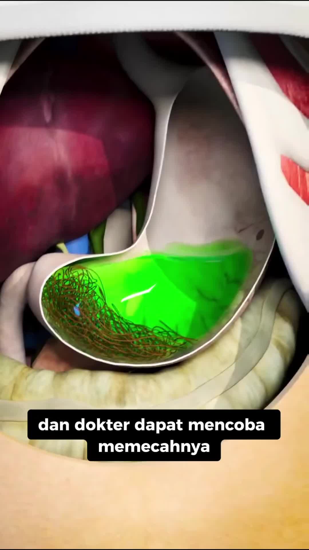 Apa yang terjadi jika orang makan rambut?